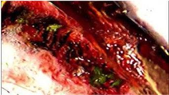 TAPE 002 - to the mountain