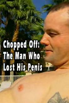 Chopped Off: The Man Who Lost His Penis film afişi
