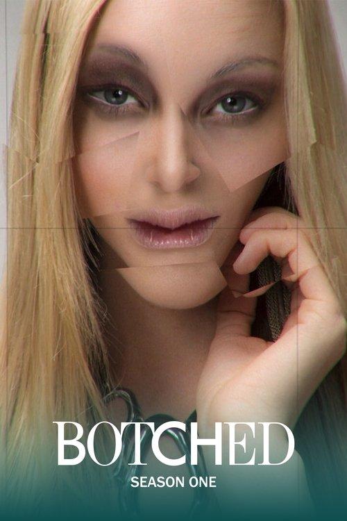 Botched Sezon 1
